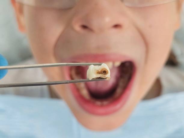 Best Urgent Tooth Repair  in Baker, LA